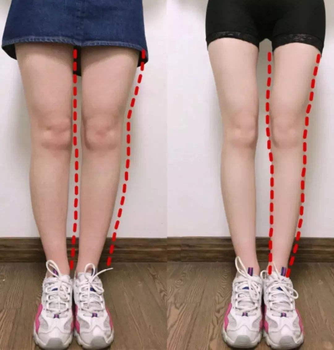 明星瘦腿方法让腿变又细又直,娱乐圈腿精女星