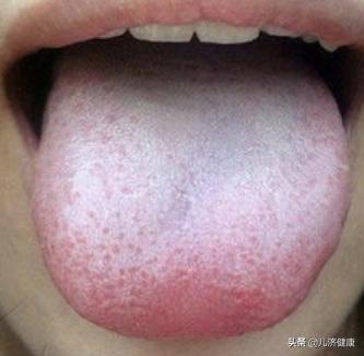 养脾祛湿最有效的方法,健脾胃祛湿好方法