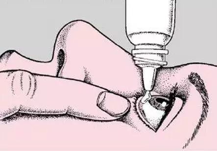 滥用眼膏剂副作用让你怀疑人生!关于红霉素眼膏,你一直不知道的