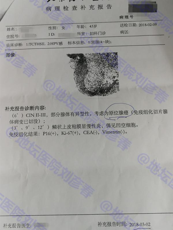 高危型hpv病毒是怎么引起的,持续感染高危hpv一定会患宫颈癌么