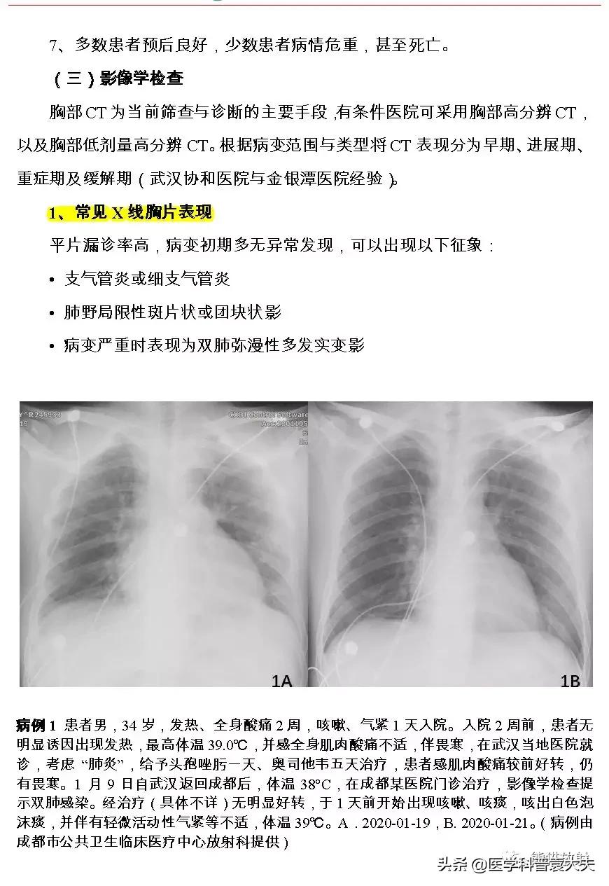 最新新型冠状病毒肺炎的指南,最新新型冠状病毒肺炎防控指南