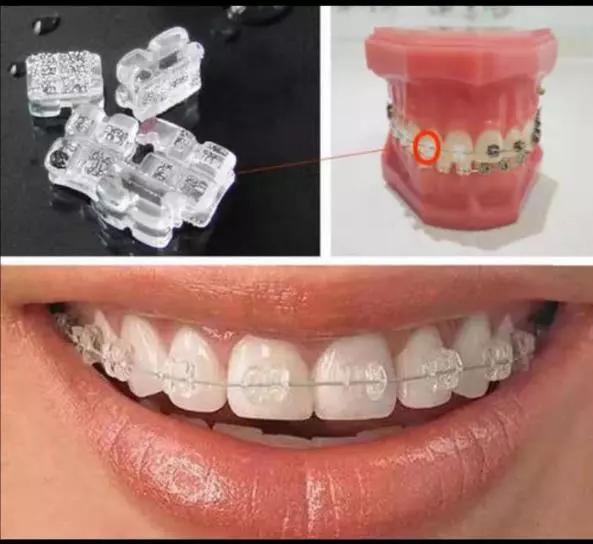 冲牙器能替代牙线,冲牙器到底能不能用