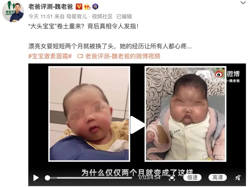 大头娃娃怎么辨别真伪,大头娃娃婴儿
