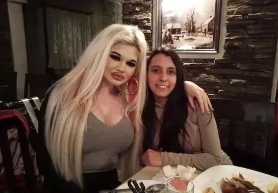 20次丰唇,20次整容成功的女人