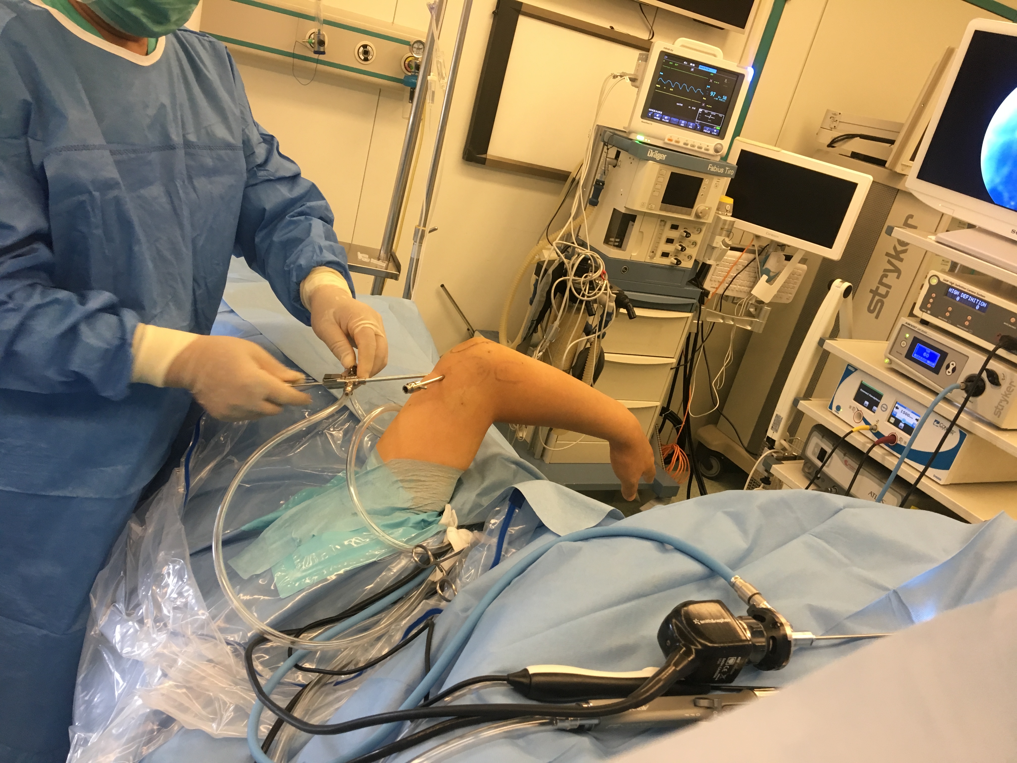 网球肘是否常见肘前外侧痛,网球肘能引肘关节和肩关节疼痛吗