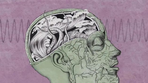 看电视能防止老年痴呆,预防老年痴呆跟着音乐眨眼睛