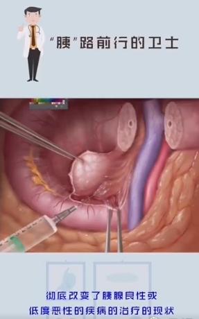 重庆市人民医院王槐志教授简历,王槐志医生的抖音号