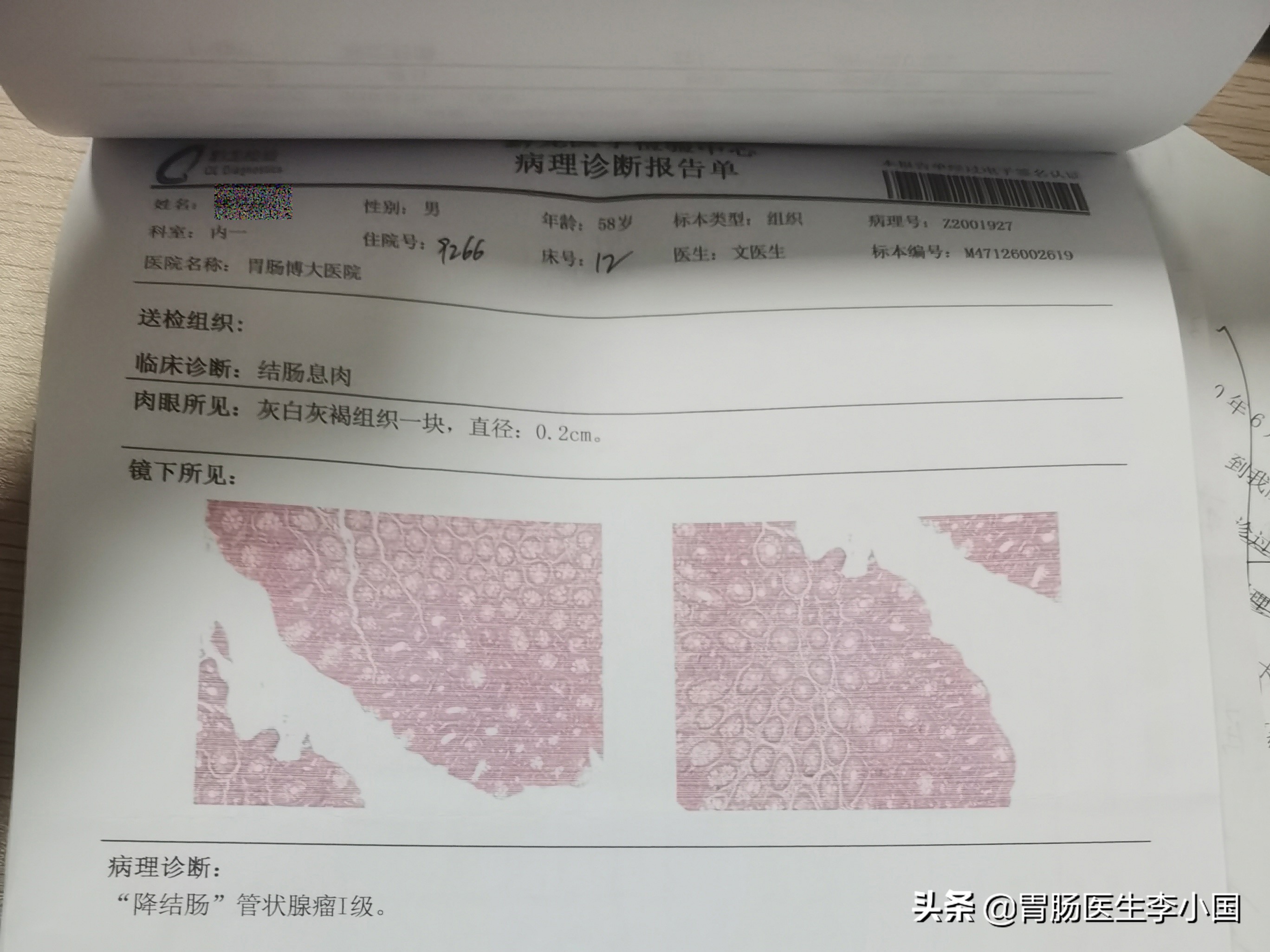 黔西北58岁贫困老汉求医路：5小时颠簸，治胃病查出结肠癌