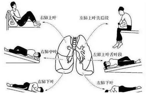 喉咙老感觉有痰怎么化解,喉咙长期有痰怎么化解