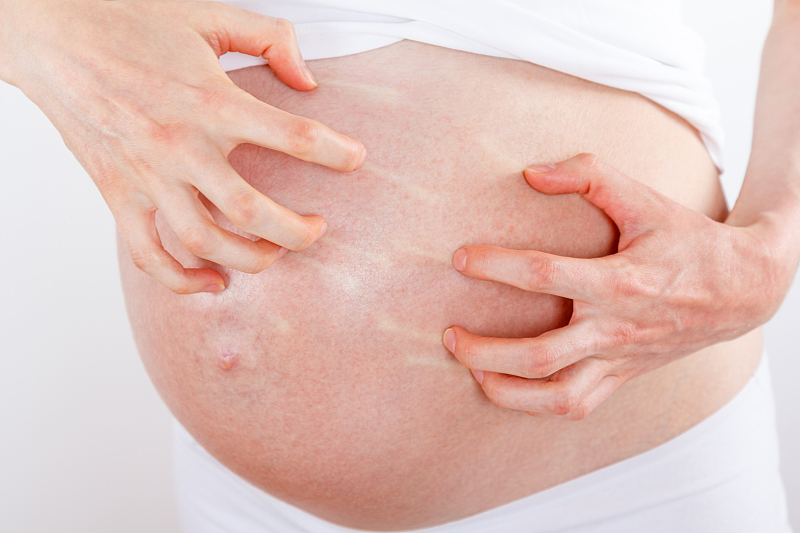 孕期皮肤瘙痒该看哪个科?