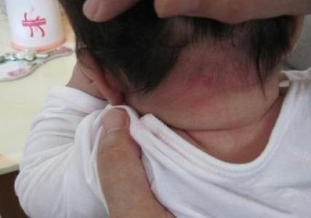 天热，没满月的宝宝满头大汗，宝妈出奇招！网友：不能剃头吗？