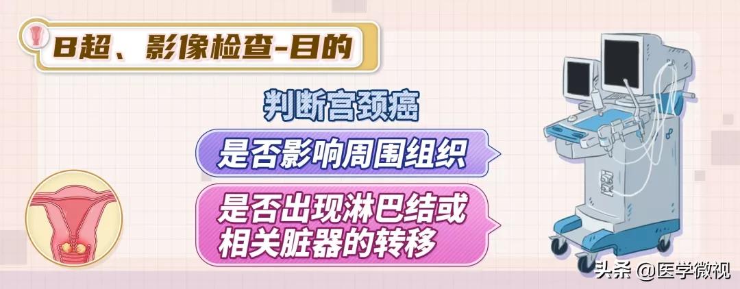 宫颈癌tct检查结果显示有轻度炎症,宫颈癌tct报告单可见挖空细胞