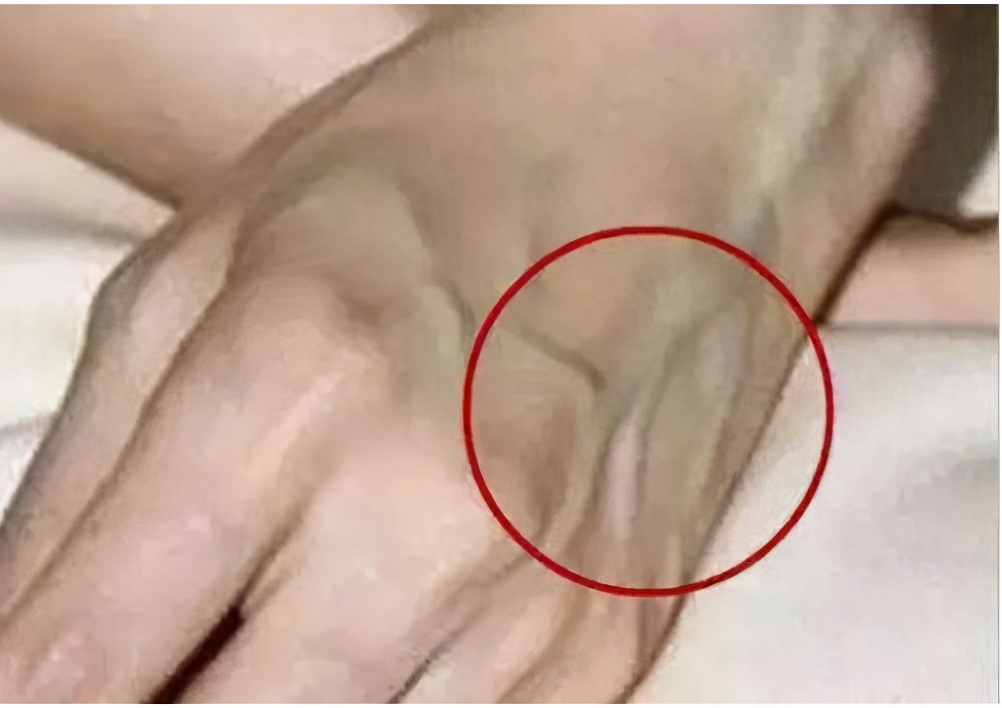 身体哪些部位出现青筋需要注意,身体4个部位出现青筋要提高警惕