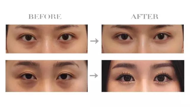 导致衰老的是哪个器官,导致衰老的原因