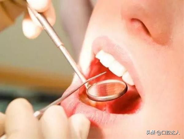 补牙能治好牙痛吗,补牙后为什么会越来越痛
