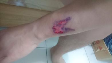 小块的白癜风能用纹身遮盖吗,白癜风用纹身能盖住吗