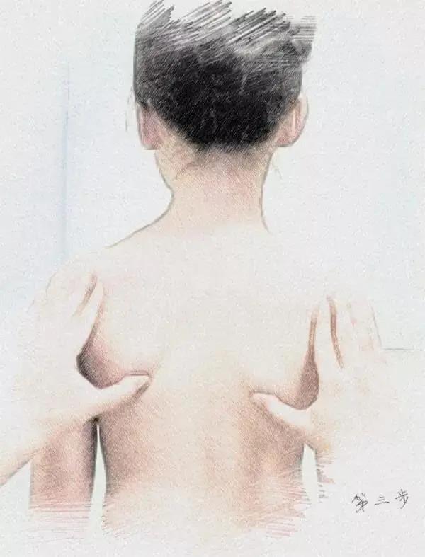 脊柱侧弯专科门诊,脊柱侧弯挂脊柱外科