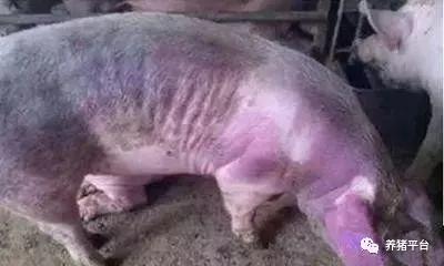 溶血性黄疸吃什么中药降下来,溶血性黄疸吃什么能快速降下去