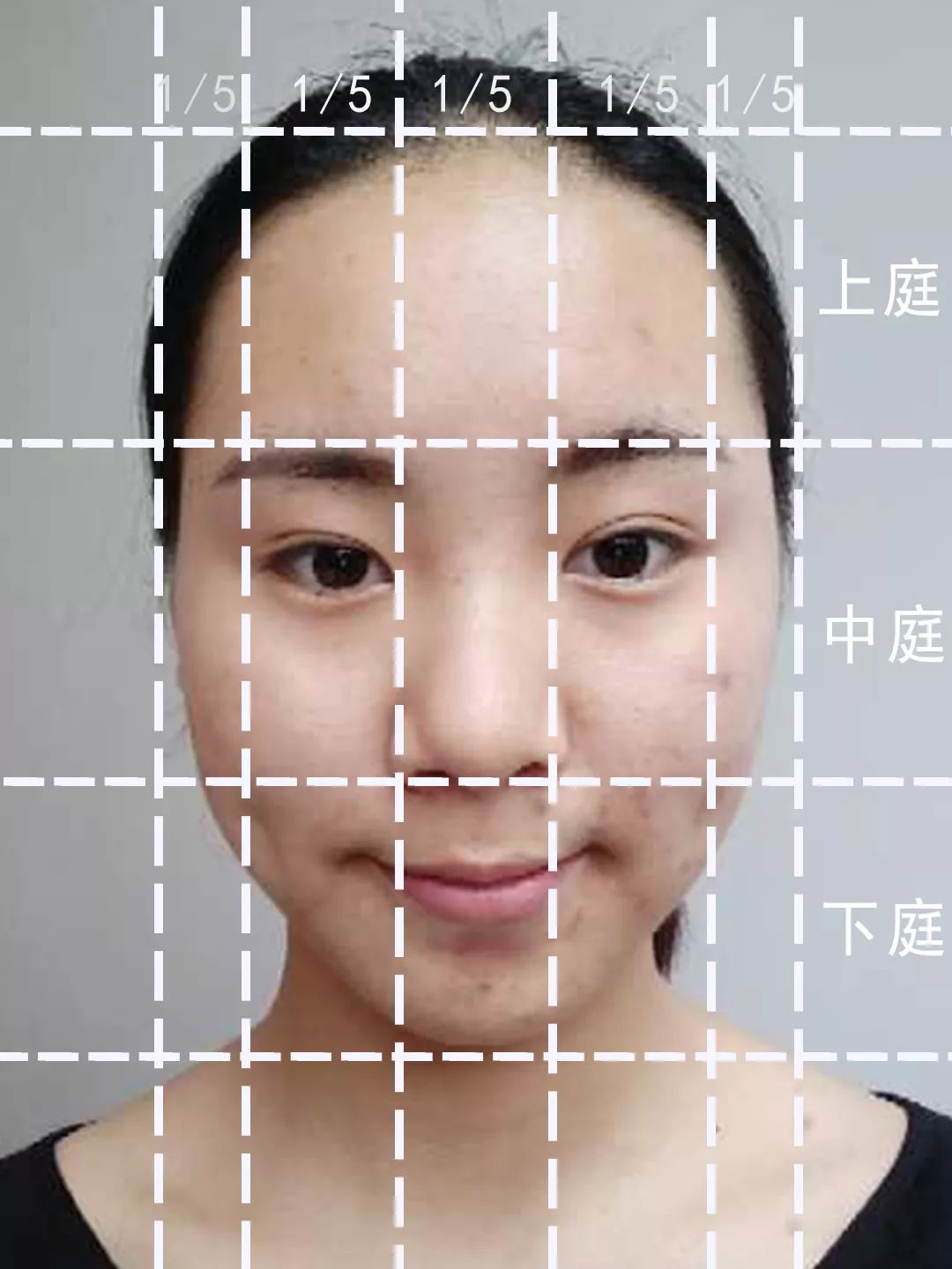 求改善痘痘真实办法,想改变脸上痘痘