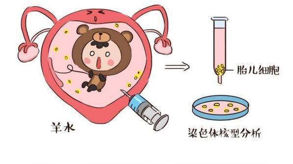 如何知道胎儿是否神经管畸形,如何知道胎儿全前脑畸形的原因