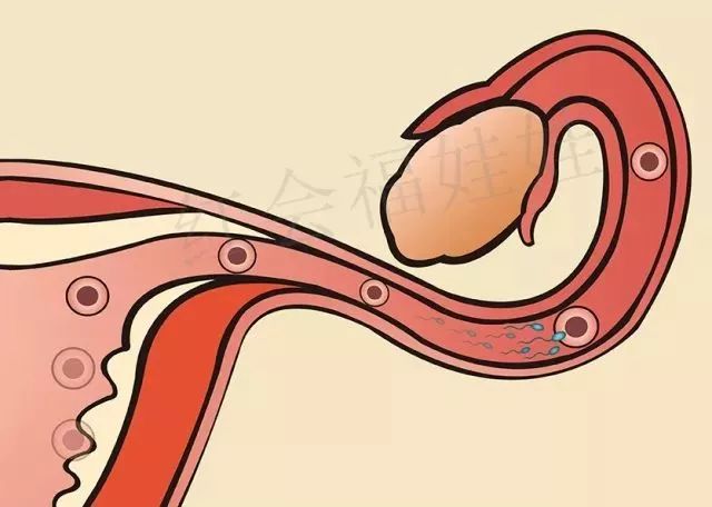 如果有这些情况建议先别怀孕,家人不会告诉你怀孕的危害