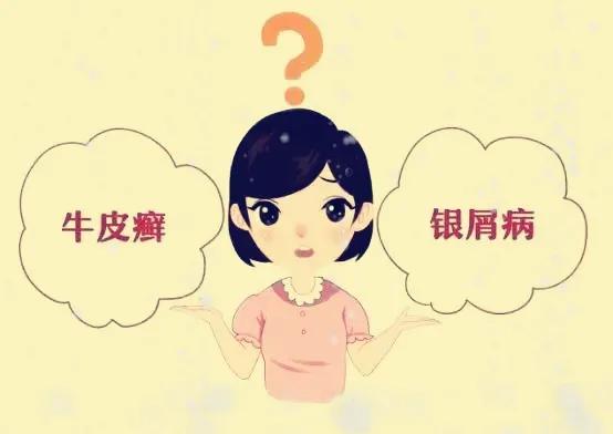 牛皮癣全身红斑大爆发怎么办,全身长满了牛皮癣属于重度吗