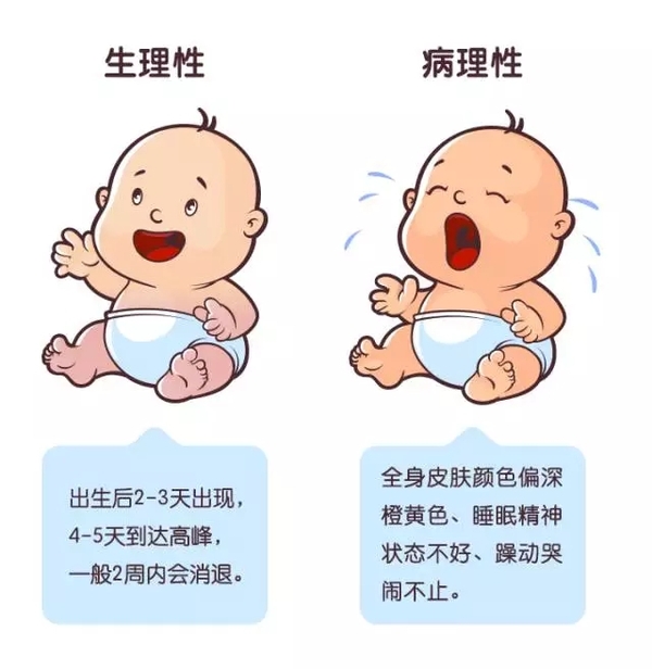 孩子出生后黄疸是怎么回事,孩子出生后变得很黄是为什么
