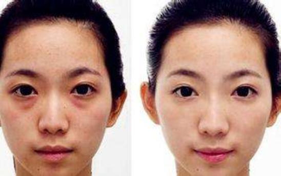 药店不起眼便宜软膏,便宜好用的祛眼袋药膏