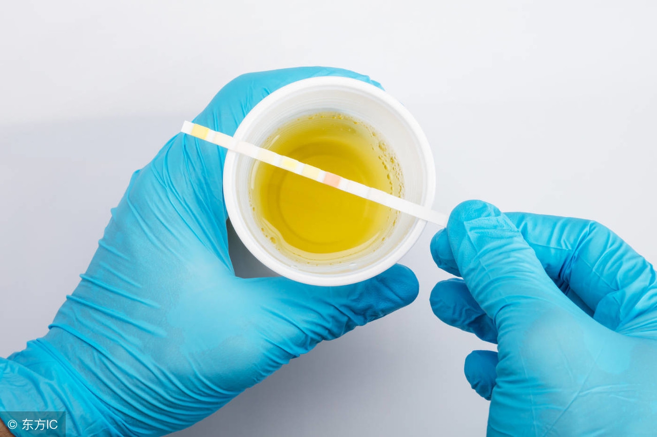 尿微量白蛋白80会伤肾功能吗,查尿微量白蛋白还要查肾功能吗