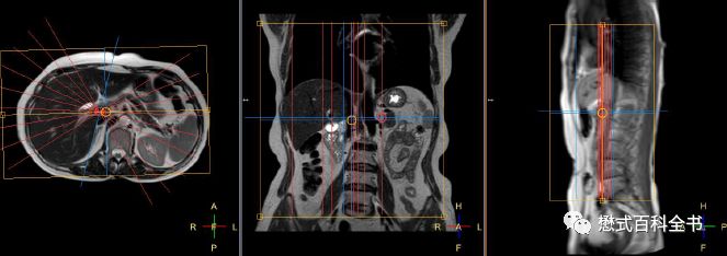 开展mrcp技术,mrcp检查操作流程