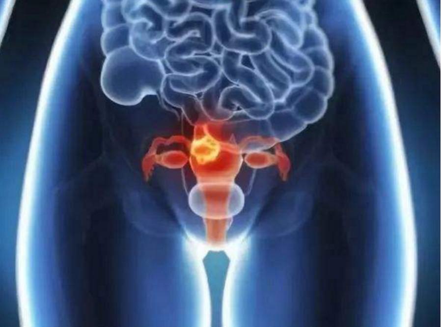 您也是这样的不老女神吗?小心癌症找上门!