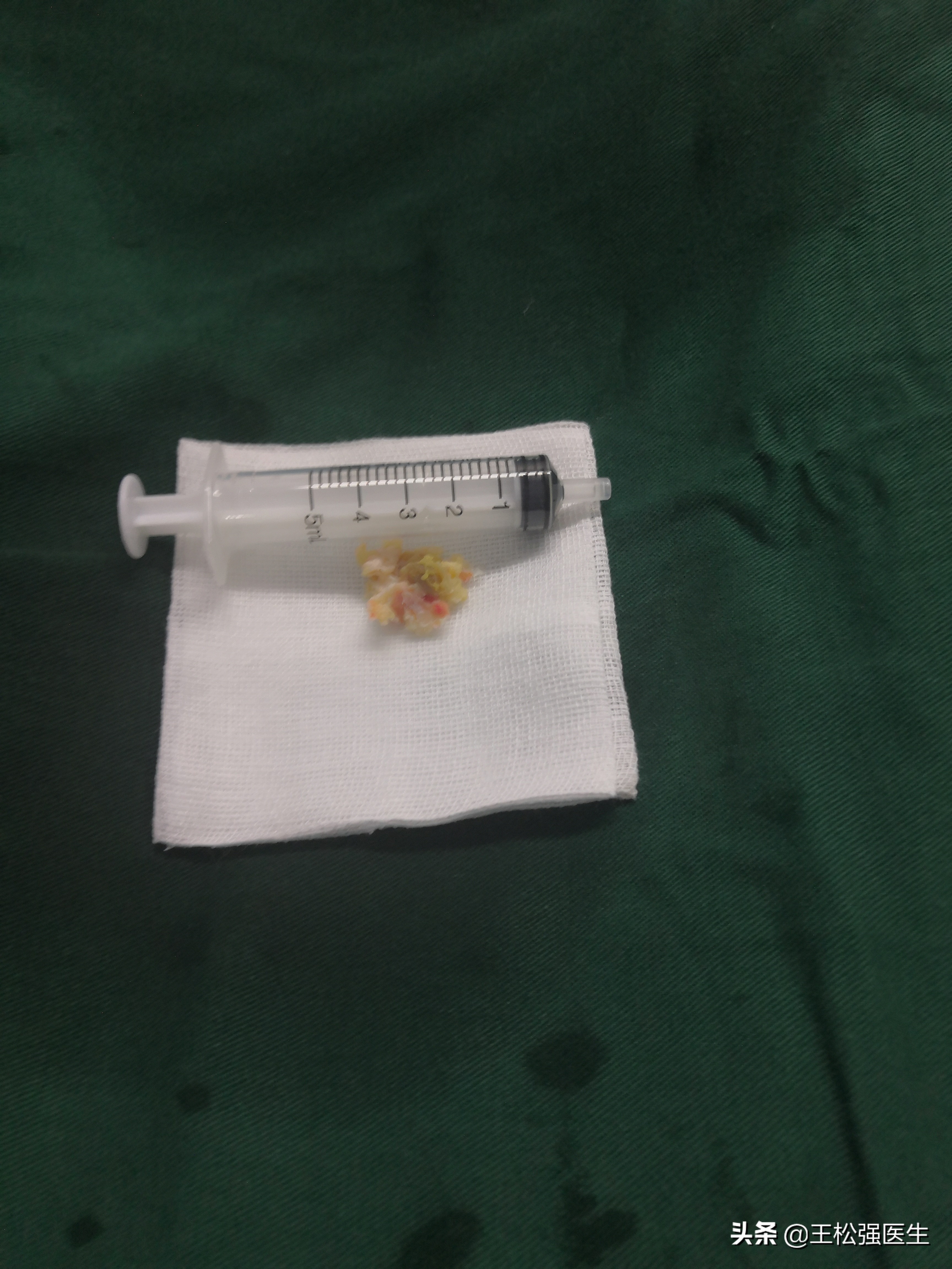 椎间孔镜术后注意的地方,椎间孔镜术后注意哪些事项