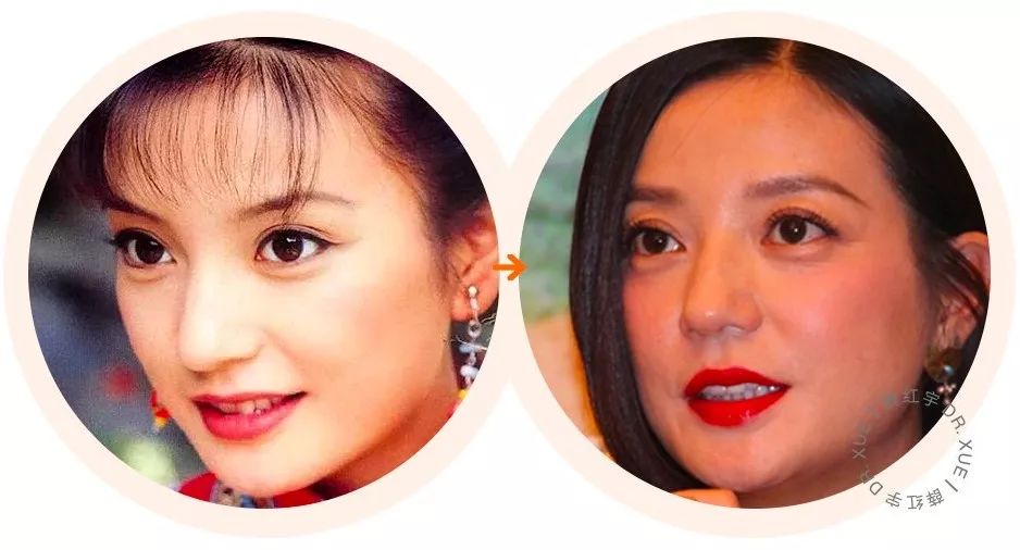 明星逃不过的年龄,眼睛衰老比较明显的明星