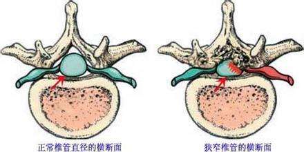你知道吗腰痛的病因差别很大,腰痛何因