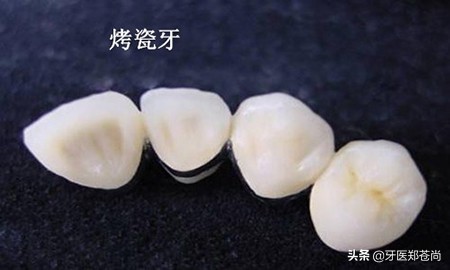 牙齿边缘缺损补救方法哪种好,牙齿缺损一角怎么修复