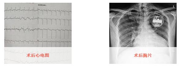 淄博市中心医院心力衰竭,淄博中心医院西院区手术