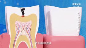 刷牙出血吃水果出血,刷牙出血吃东西出血怎么回事