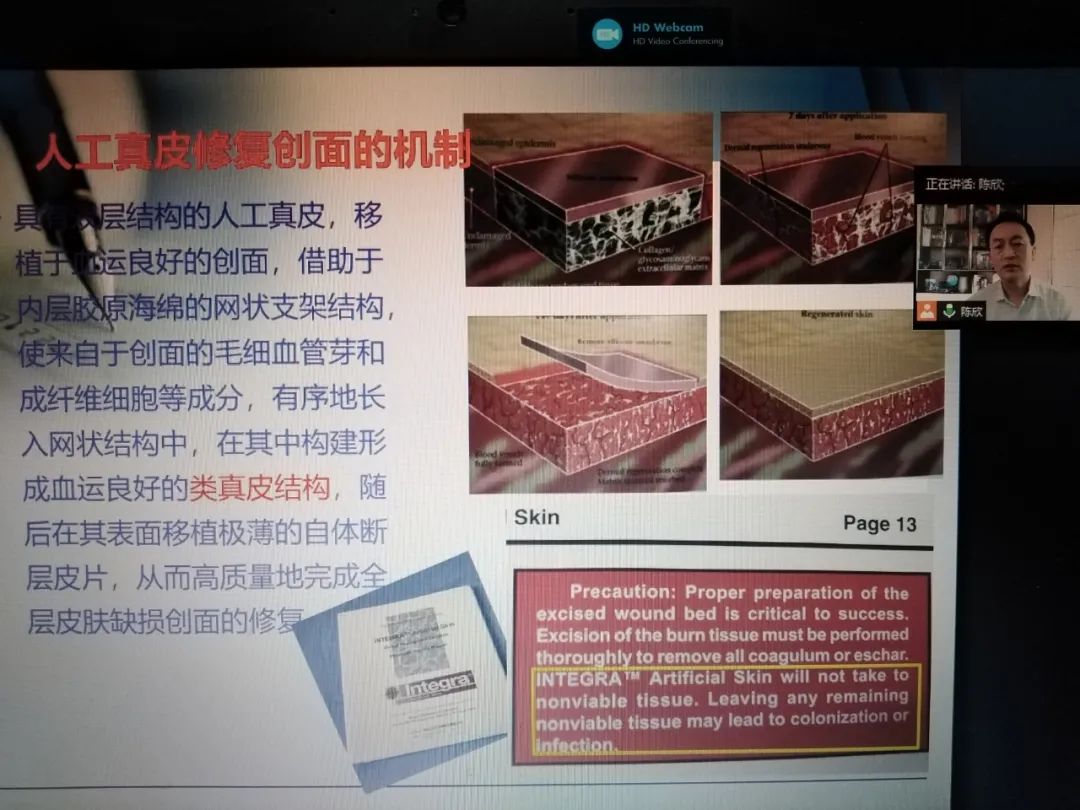 【学术交流】烧伤科成功举办第七期难愈性创面修复新技术培训班