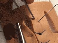 十种外科基本缝合方式详解,手术切口缝合有哪几种