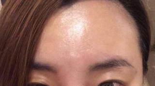 阿诗帕丽水蛭素祛痘冻干粉,水蛭素这产品效果怎么样