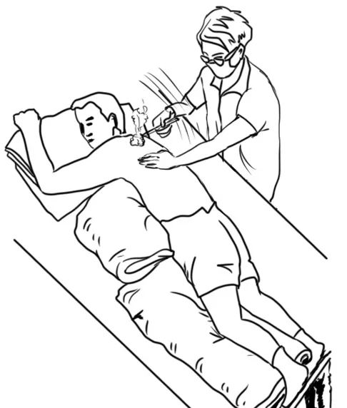 针灸治寒湿腰疼的辨证分型,寒湿腰痛的针灸外治方法