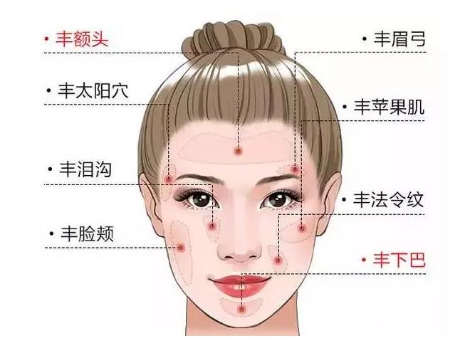 自体脂肪移植除皱,脸部自体脂肪移植整形