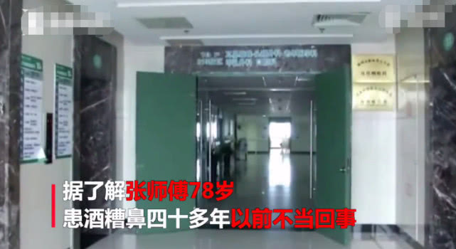 62岁大爷酗酒40年喝成河马脖,78岁老大爷喝酒