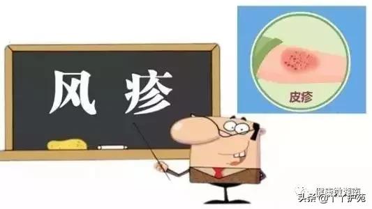 风疹为啥不让见风,风疹民间说法