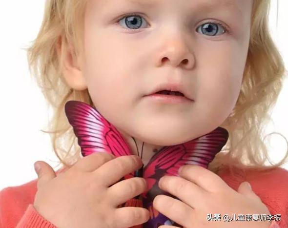 儿童甲亢的表现症状和危害怎么治,儿童有甲亢算大病吗