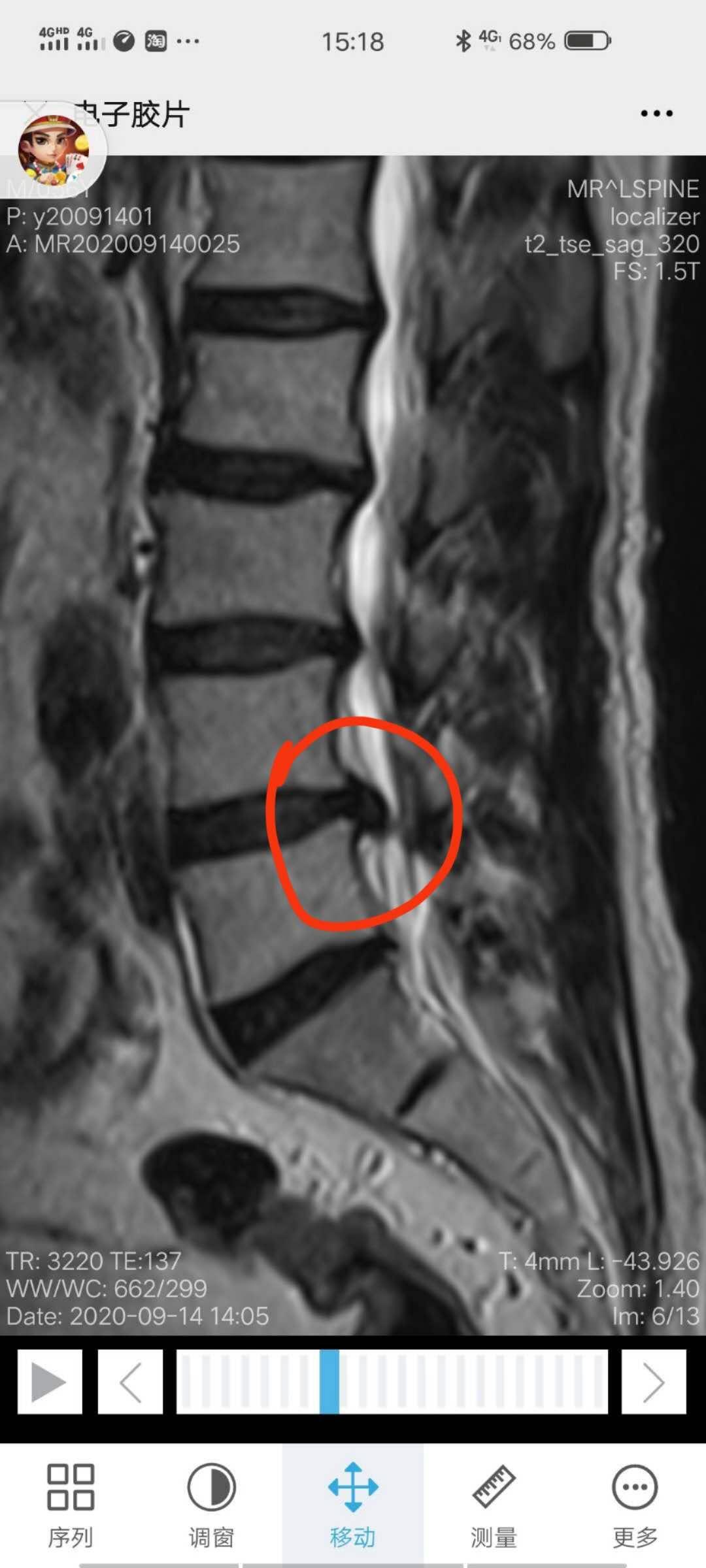 你还在受困扰吗,你是否还在被腰疼困扰