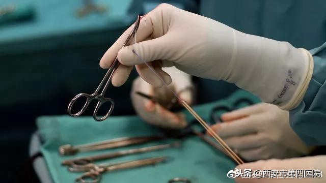 非典型面肌痉挛如何治疗,面肌痉挛最好的治疗方法