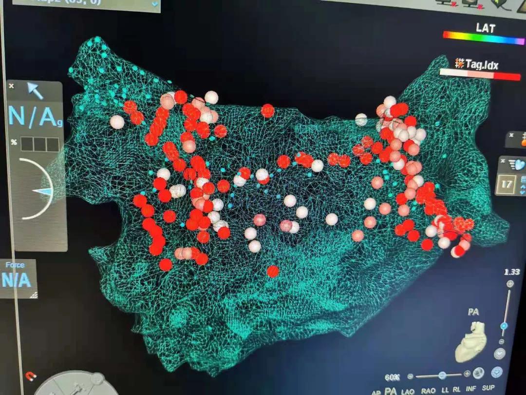 患者的治疗方案?患者的选择或是医生的选择,如何选择最优解?
