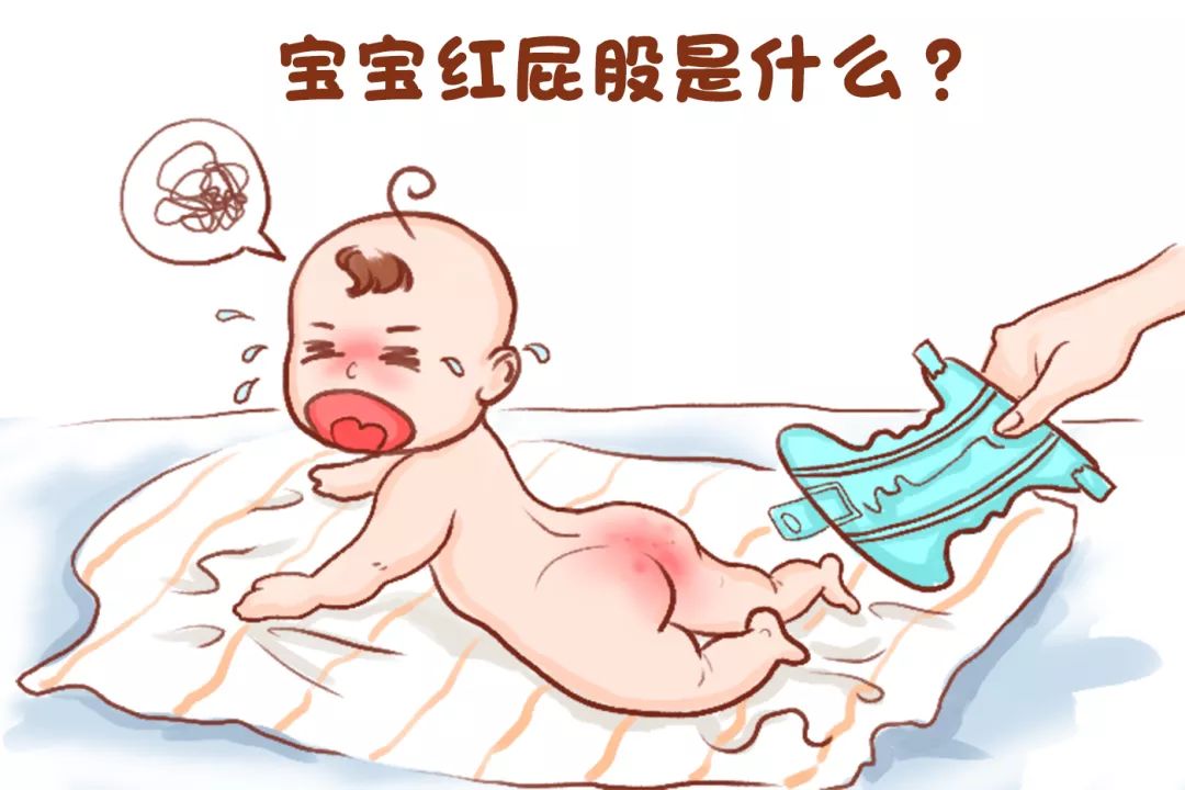 宝宝“红屁股”反反复复?别总让纸尿裤背锅,孕妈护理也有错