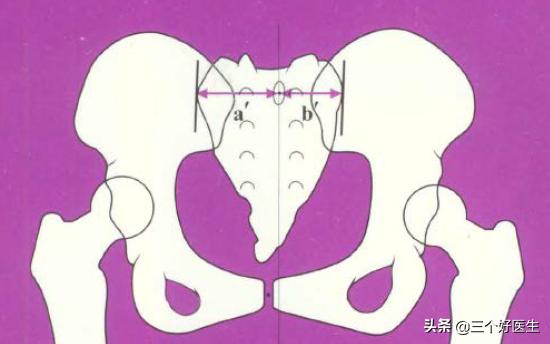 骶骨仰头错位腿会变长吗,骶骨仰头就是骶骨上翘吗